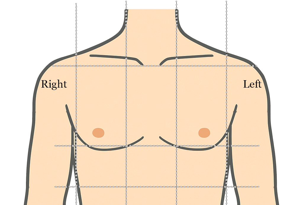 Body Diagram